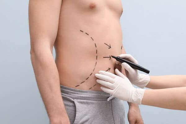 تجربتي مع التجميل في تركيا