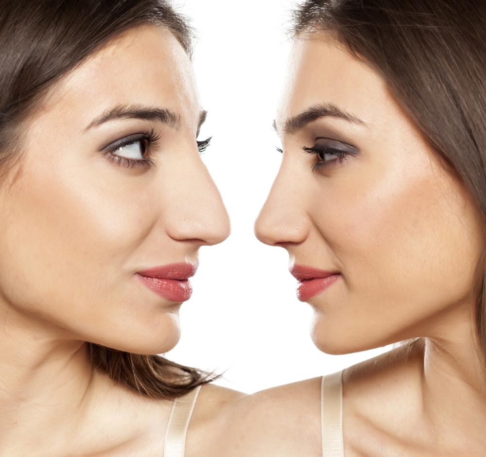 تجربتي مع التجميل في تركيا