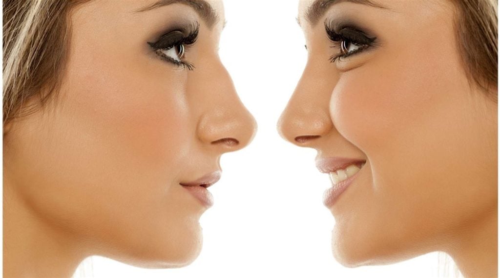 تجربتي مع تجميل الانف في تركيا