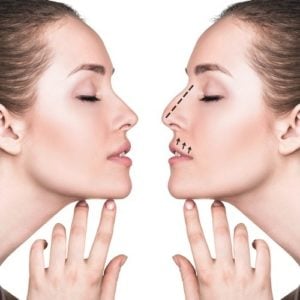 تجربتي مع تجميل الانف في تركيا