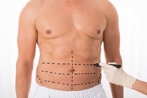 تجربتي مع تجميل الانف في تركيا